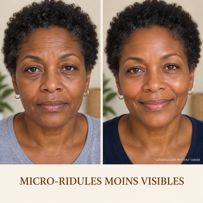 Micro-ridules moins visibles - resultats variables